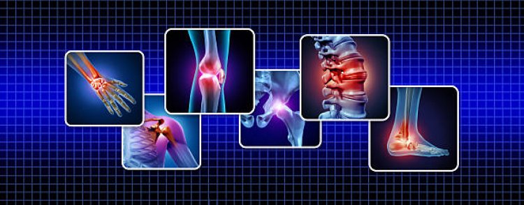 Orthopedic Specialist in Pasadena TX: Restoring Mobility with Expert Care.